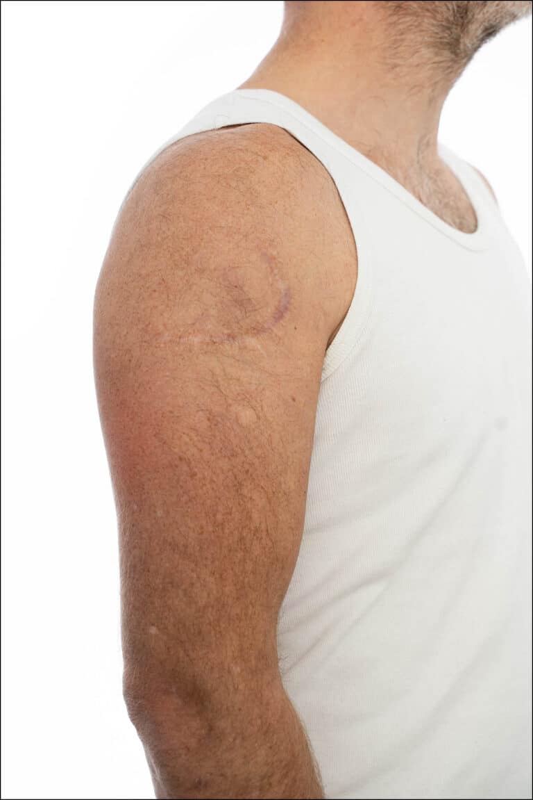 Forsikringsbillede fotografering